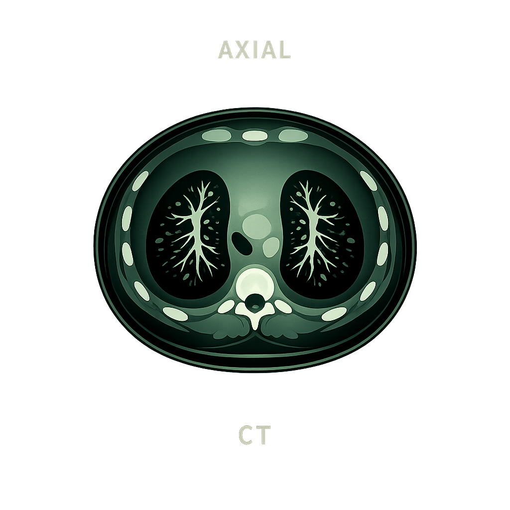 Thorax CT axial