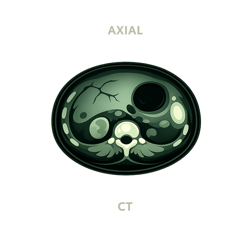 Abdomen CT axial
